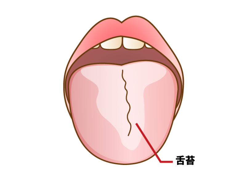 舌苔|ABC歯科